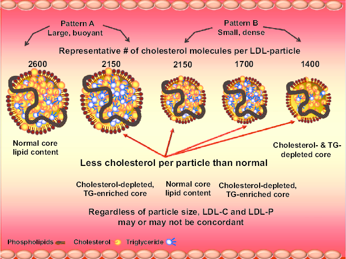 Low density lipoprotein LDL composition depending on LDL particle size and
