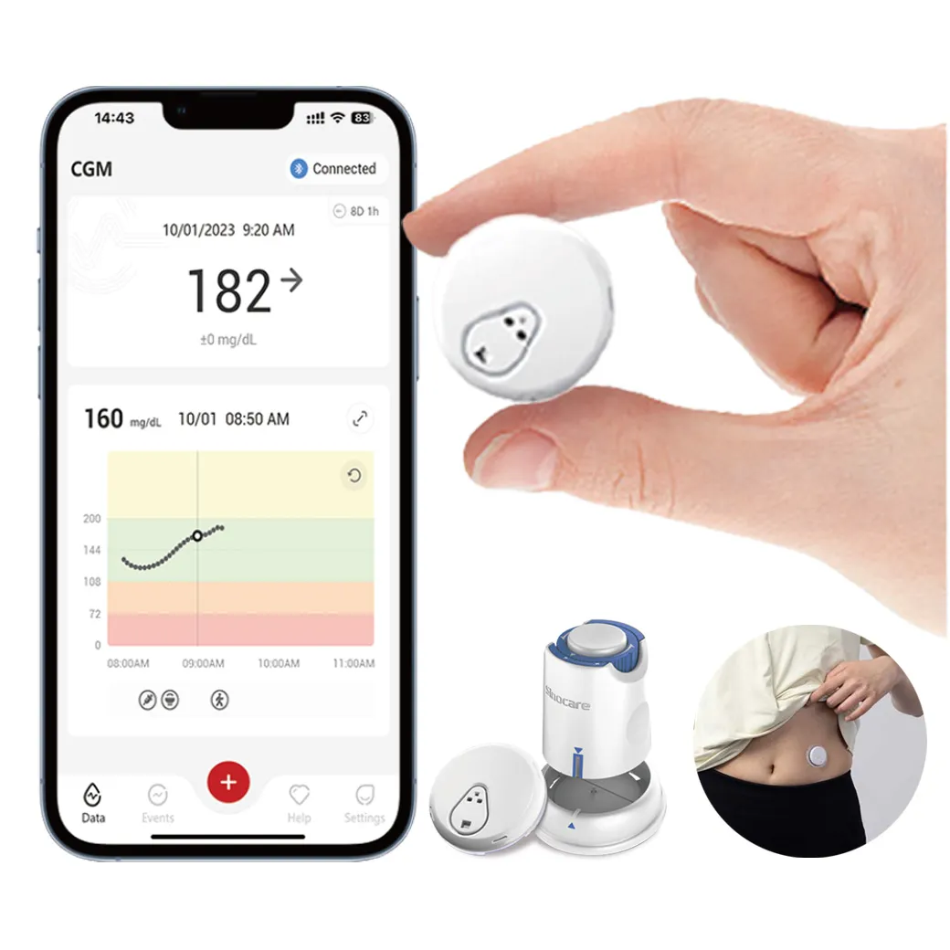 ทำไมคนเป็นเบาหวานควรติด CGM? กุญแจสำคัญสู่การคุมน้ำตาลแบบแม่นยำ